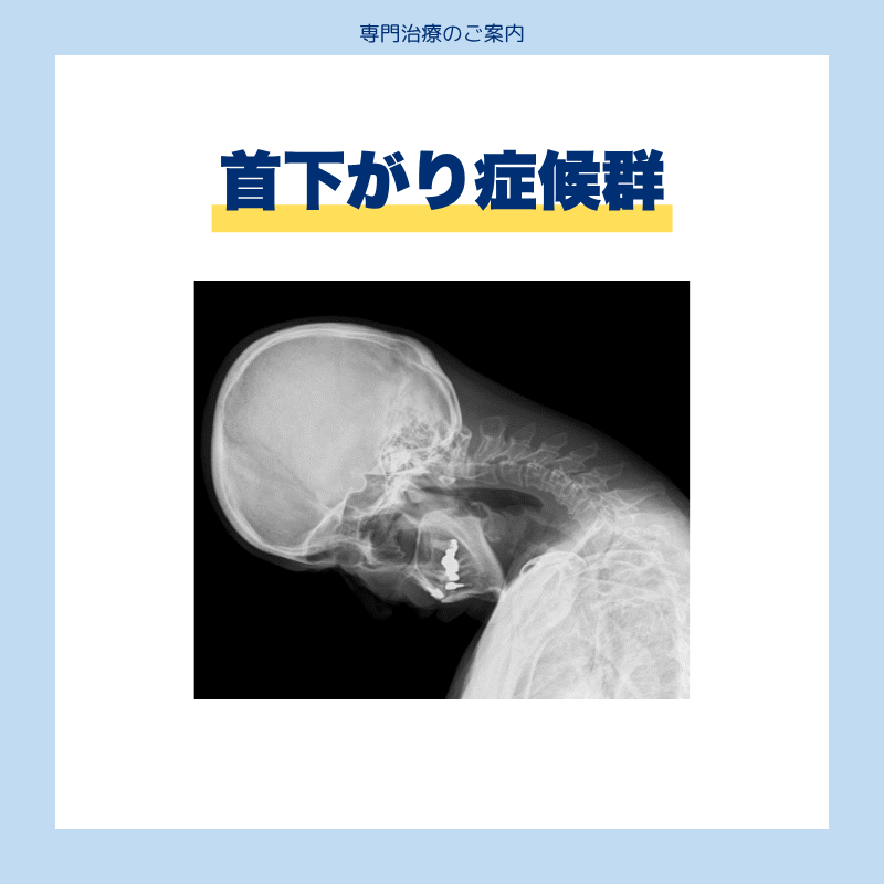 首下がり症候群