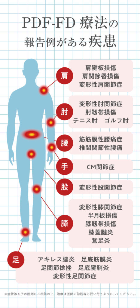 PDF-FD療法の報告例がある疾患を体の部位別に紹介